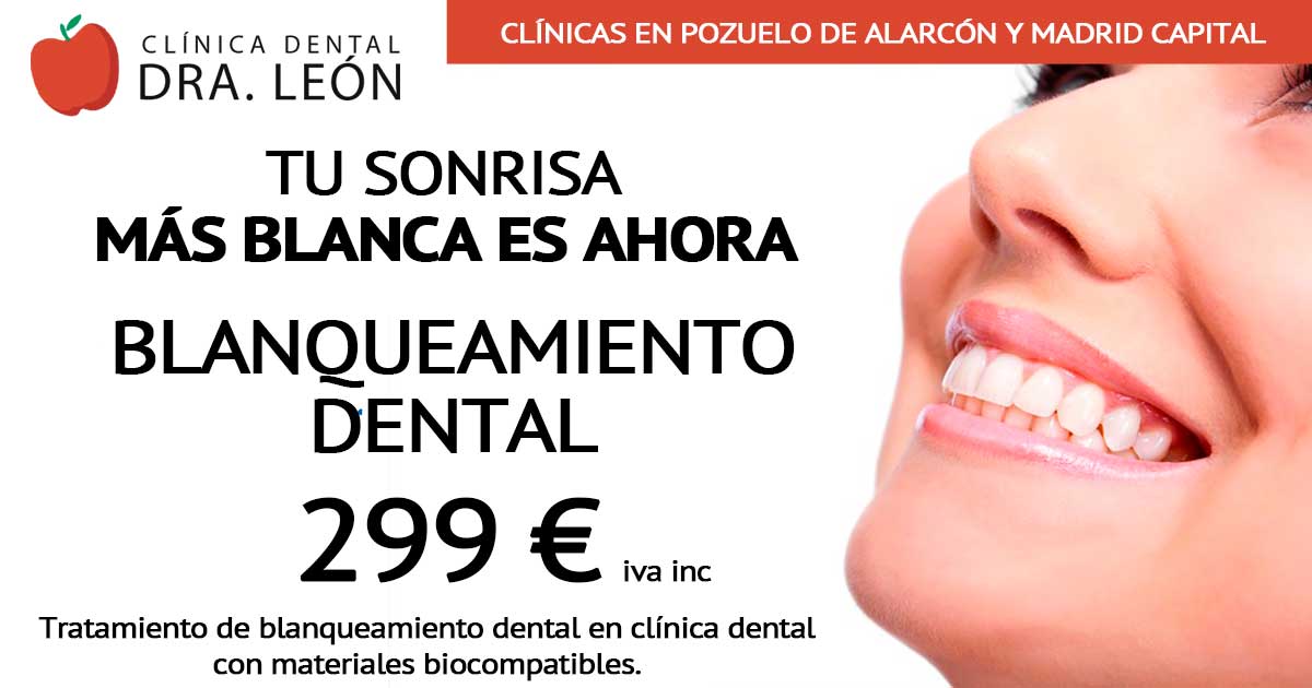 promoción blanqueamiento dental en Madrid